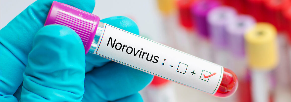 Norovirus test results in a lab