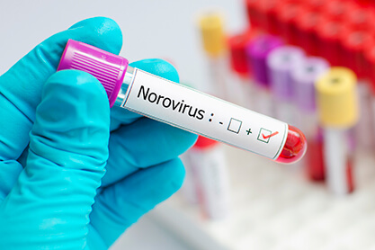 Norovirus test results in a lab