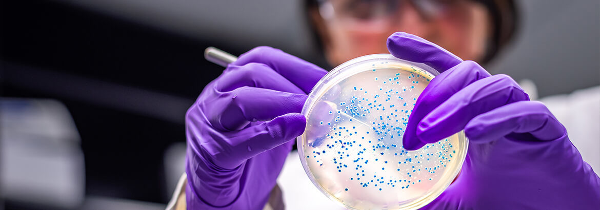 Salmonella being examined by a lab technician