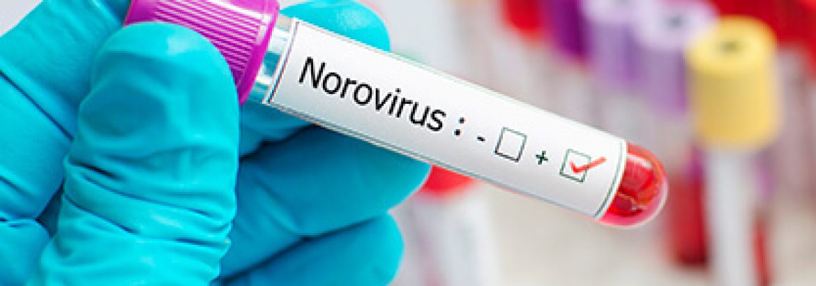 Norovirus test results in a lab