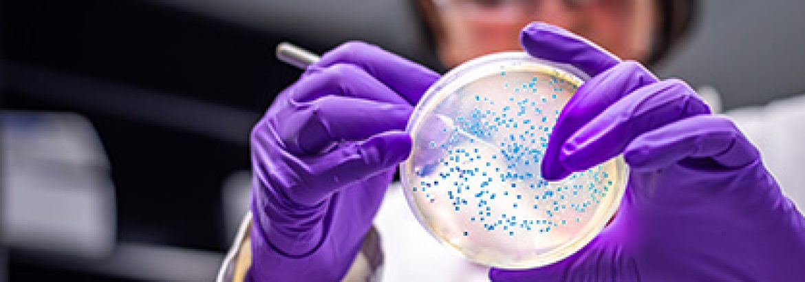 Salmonella being examined by a lab technician